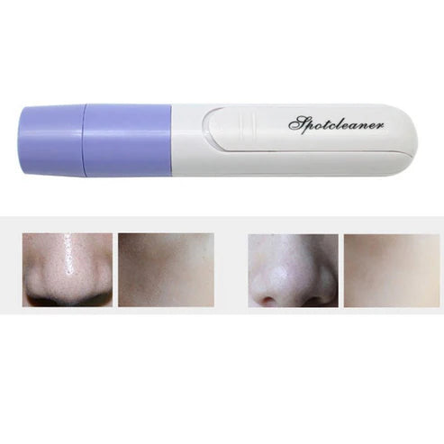 Electric Pore Cleanser Facial Massager – Deep clean and minimize pores – Qaswa Beauty UAE

Pore vacuum device for blackhead removal and oily skin control

Portable facial pore cleanser with suction heads – skincare tool